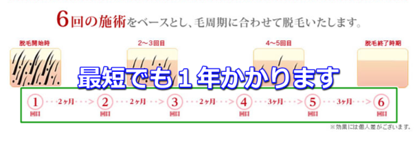 銀座カラー 赤ちゃん肌脱毛
